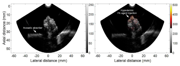 경직장 초음파/광음향 융합 프로브를 통해 획득된 Normal 마우스 모델에서의 Hypodermic PA agent injection 후의 (왼쪽) 초음파 영상, (오른쪽) 초음파/광음향 융합영상