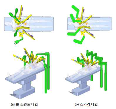 c-type (a), (b)안의 담낭절제술 포팅 모식도