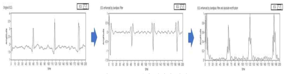 ECG 센서 전처리 과정