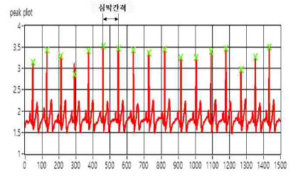 심전도 센서 결과