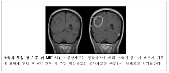 조영제를 사용한 목적 조직의 시각화