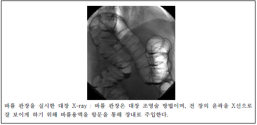 바륨 조영제를 사용한 X-ray