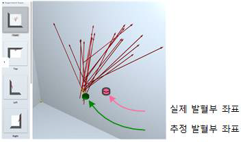 발혈부 추정 알고리즘 평가 방법