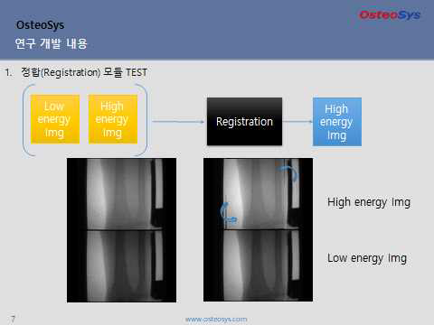 정합(Registration) 모듈 방식