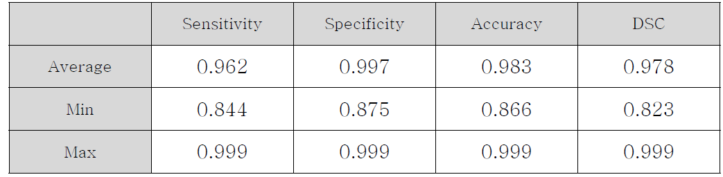 Deconvolution-Net 모델에서의 뼈 추출에 대한 정확성 평가 결과