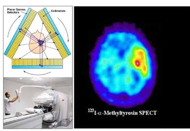 단일광자단층영상(SPECT) 시스템과 영상