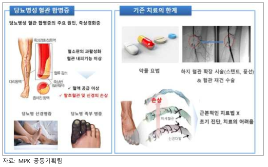 당뇨병성 혈관 합병증 및 기존 치료법의 한계