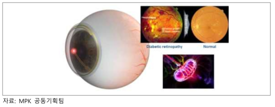광 생체 변조를 이용한 당뇨성 망막 병증 예방기술의 개념