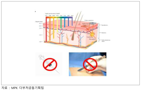 광기반 광전자 기술을 활용한 주사기, 메쓰없이 당뇨병을 관리하고 치료