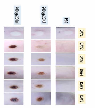 Assessment of toxicity on skin cell of micei