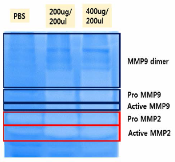 Variation of mmp on skin cell of micei