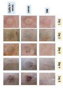 Neutralizational effect of jellyfish toxicity of green tea taken at room temperature