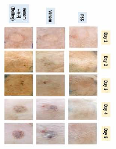 Neutralizational effect of jellyfish toxicity of green tea taken with boiling water