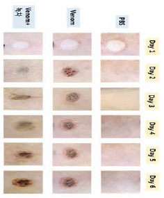 Neutralizational effect of jellyfish toxicity of green tea taken at room temperature-6th days