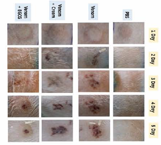 Neutralizational effect of jellyfish toxicity using low concentration of EGCG cream