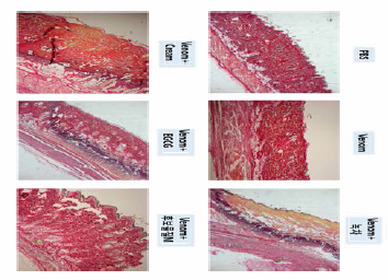 Picro-sirius red staining using tissues of mice