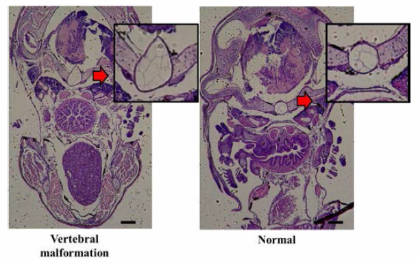 Comparative of histological status between normal and malformation