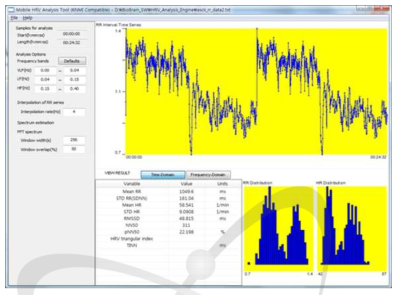 심박변이도 지표를 추출하는 분석엔진의 인터페이스 예