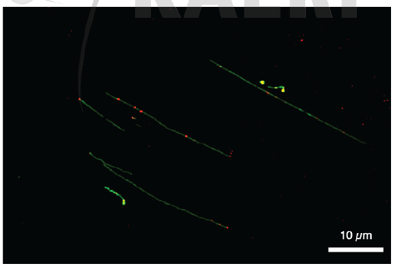 단일 분자 DNA (녹색 선) 현미경 사진과 DNA 손상 형광 표지 (붉은 점)