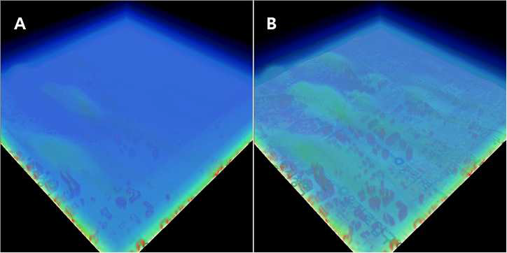 3D체적 – 투과수준에 따른 volume rendering 결과 비교: A(1%), B(10%)