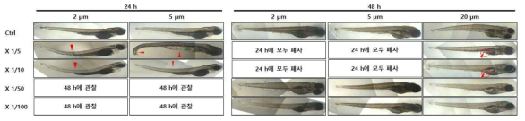 크기 및 농도별 PS 미세플라스틱 처리 후 지브라피쉬 larvae phenotype 변화 관찰