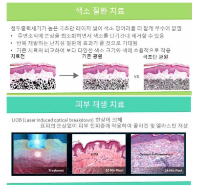 극초단 레이저 기반 피부 의료기 특징