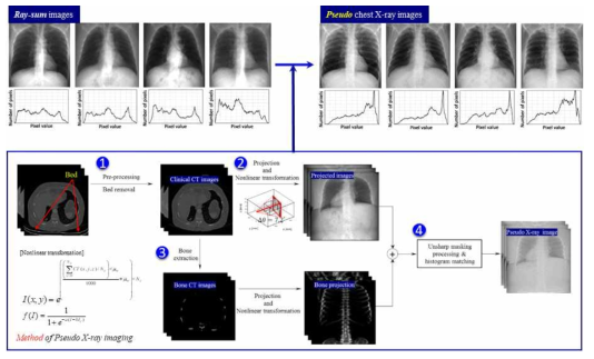 Pseudo X-ray 영상화 기술 방법