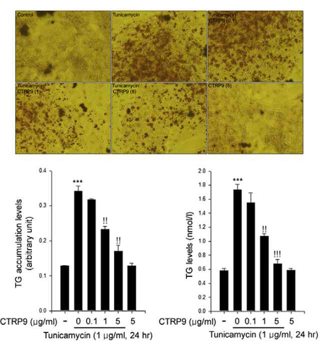 CTRP9의 HepG2 세포에서 팔미틱산 또는 튜니카마이신 유발 중성지방 침착 억제 효과