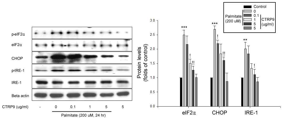 CTRP9의 HepG2 세포에서 팔미틱산 또는 튜니카마이신 유발 ER stress 억제 효과