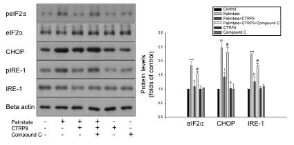 CTRP9의 팔미틱산 유발 ER stress 억제효과에 AMPK와 autophagy 관여 여부확인