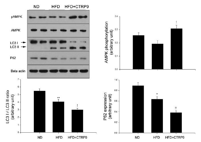 고지방식이를 한 쥐의 간에서 CTRP9의 과발현으로 인한 AMPK 인산화와 autophagy 지표들의 증가확인