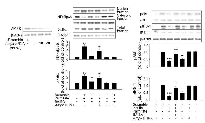 BAIBA의 C2C12 세포에서 팔미틱산으로 인한 염증 및 인슐린 저항성에 대한 AMPK의