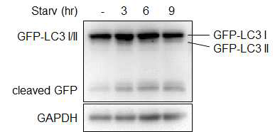 cleaved GFP 생성을 이용한 autophagy flux 평가