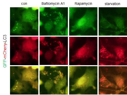 GFP-mCherry-LC3를 이용한 autophagy flux 측정