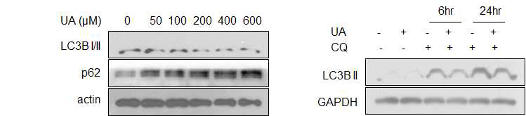 uric acid에 의한 autophagy 억제