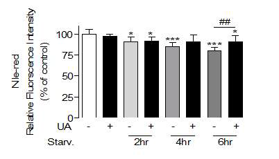 uric acid에 의한 autophagy 억제가 지방대사에 미치는 영향