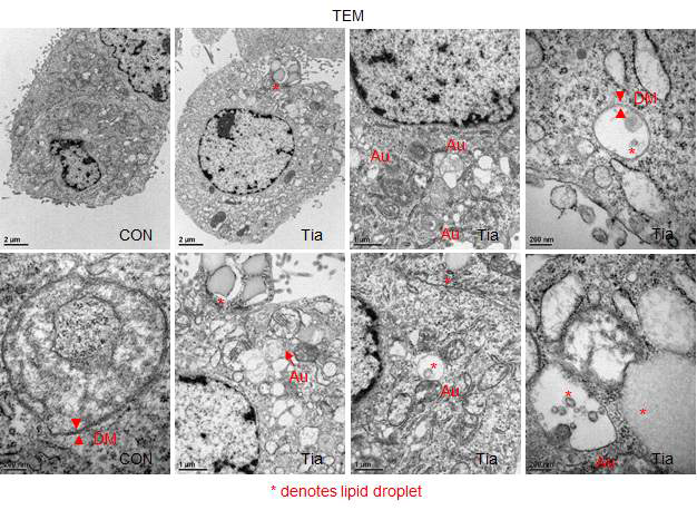 tianeptine에 의한 lipophagy 억제