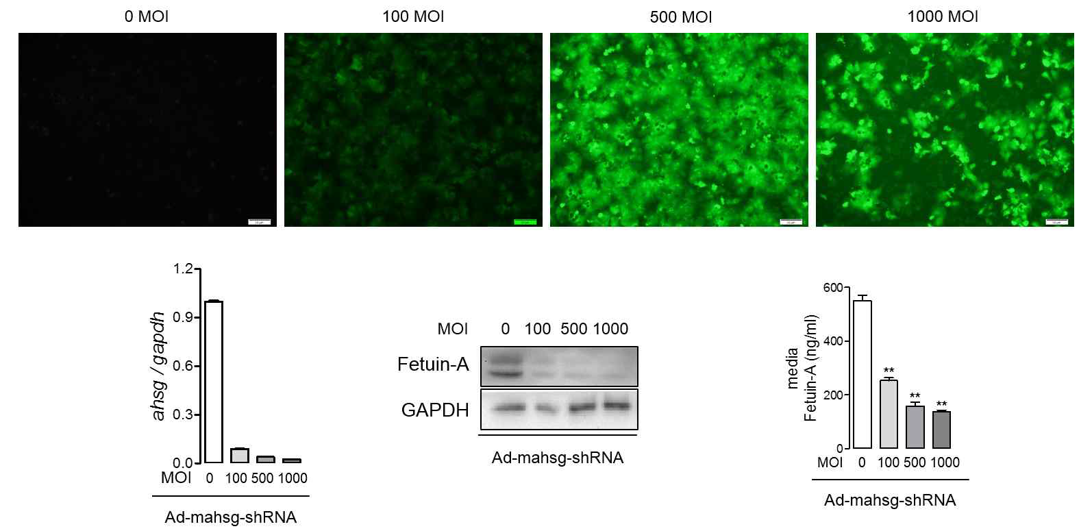 primary mouse hepatocyte에 Ad-mahsg-shRNA를 infection시킨후, Fetuin-A의 유전자, 단백질 발현 관찰 및 media의 Fetuin-A 농도 분석