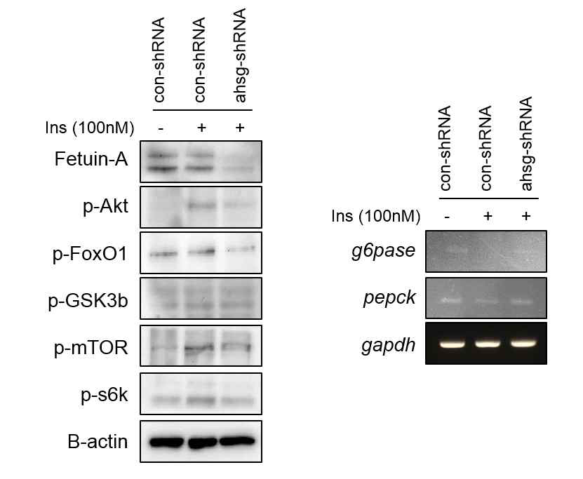 primary mouse hepatocyte에서 Fetuin-A knockdown에 의한 인슐린 신호전달 변화 확인 및 Akt 활성 변화에 따른 표적 유전자 발현 확인