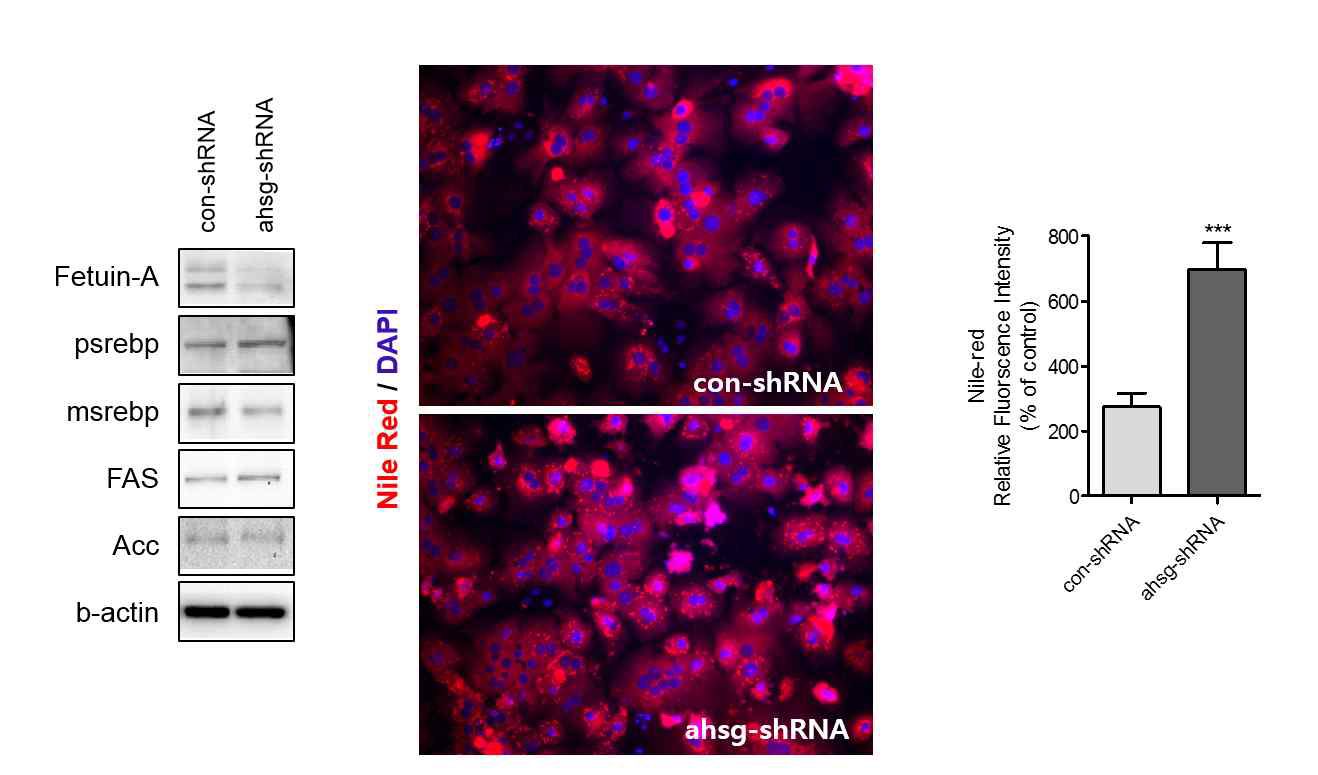 primary mouse hepatocyte에서 Fetuin-A knockdown에 따른 지질대사 관련 단백질 발현 관찰 및 중성지방 함량 확인