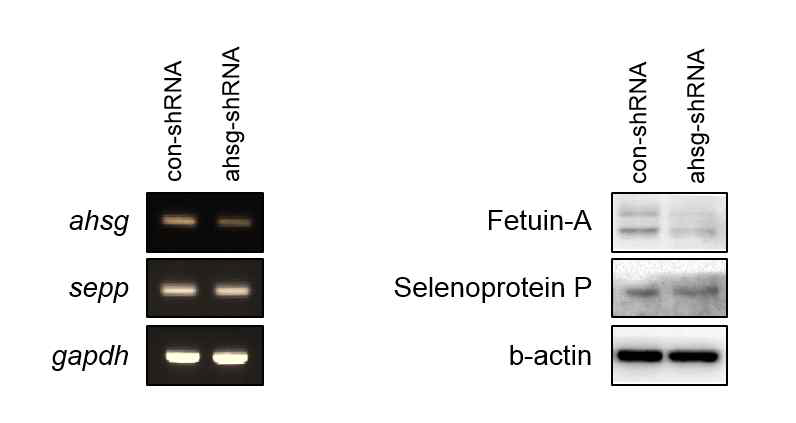 primary mouse hepatocyte에서 Fetuin-A knockdown에 의한 다른 hepatokine의 유전자 및 단백질 발현 분석