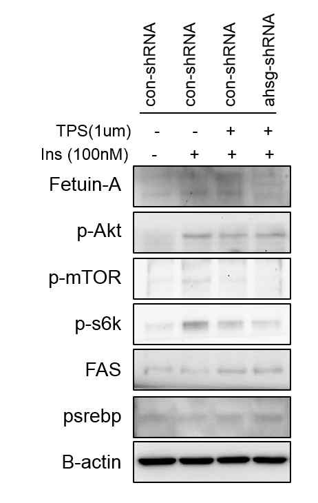 primary mouse hepatocyte에서 Fetuin-A 발현 유무에 따른 인슐린 신호전달 및 지방 생합성 단백질 발현 관찰