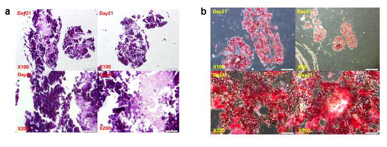 Osteogenic differentiation of Adipose-derived Stem Cell in 3D culture
