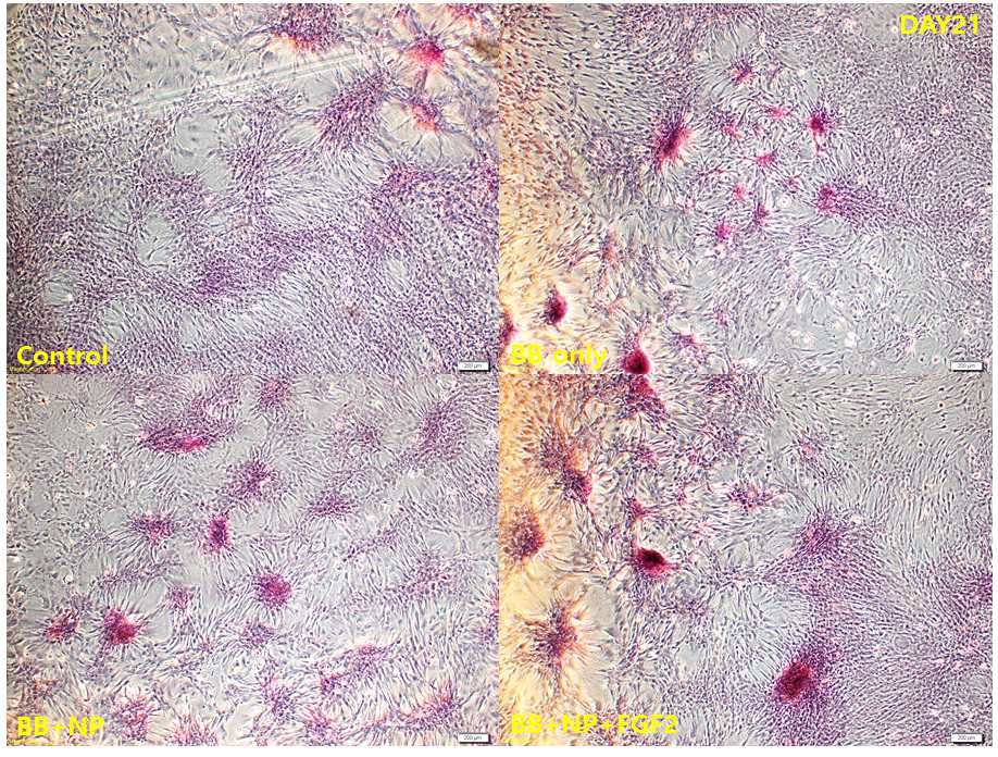 ARS staining for confirmation of osteogenesis