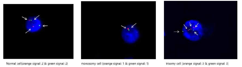FISH를 이용한 염색제 이수성 테스트의 예