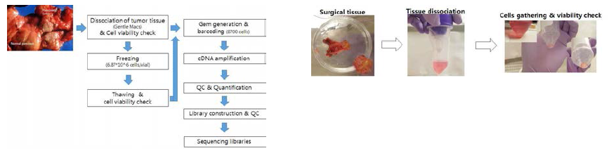 Process for pancreatic cancer specimens and cell counting