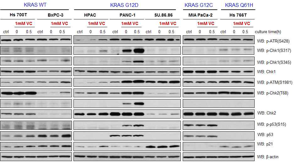 Vitamin C increases the DNA damage of KRAS G12D-mutant pancreatic cancer cells