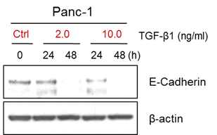 TGF-β1 induced the downregulation of E-cadherin expression n Panc-1 cells