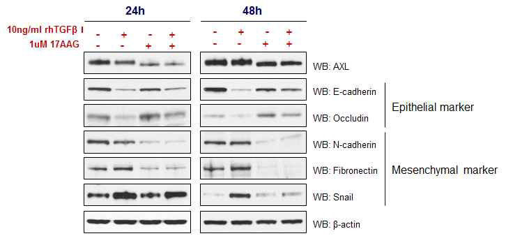 TGF-β1 induced the downregulation of epithelial marekrs and up-regulation of mesenchymal mrkers in Panc-1 cells