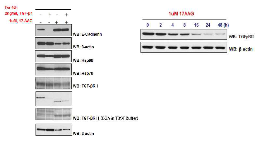 HSP90 inhibition by 17-AAG induces dgradation of TGF-βRII. HSP90 inhibition also regulates EMT-assoaciated proteins. TGF-β1-induced down-regulation of E-cadherin and up-regulation of N-cadherin, fibronectin and vimentn were restored by 17-AAG in Panc-1 cells